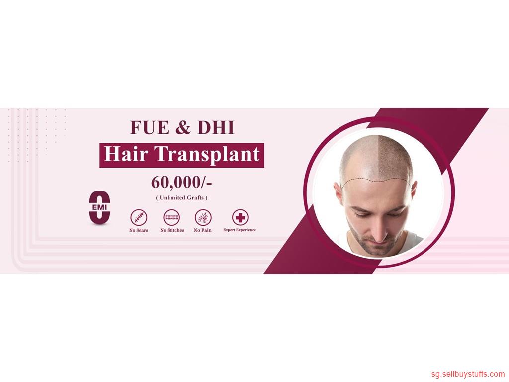 second hand/new: Hair transplant surgery in Hyderabad